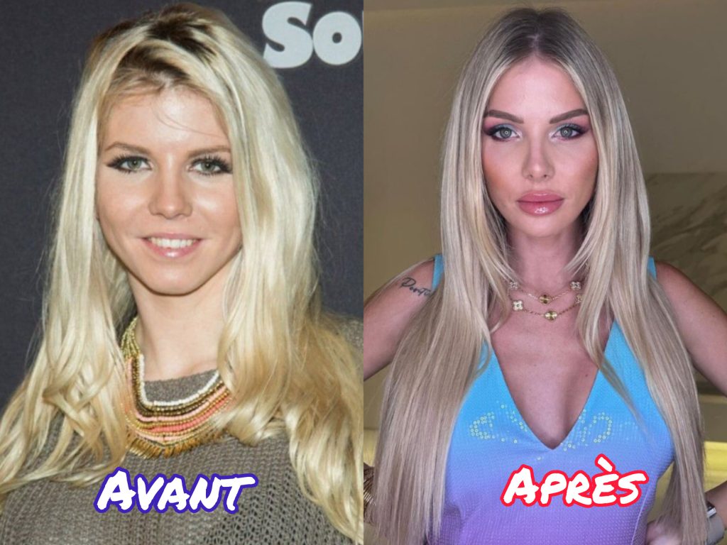Jessica Thivenin avant et après la chirurgie esthétique 